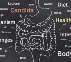 Candida Causes chart